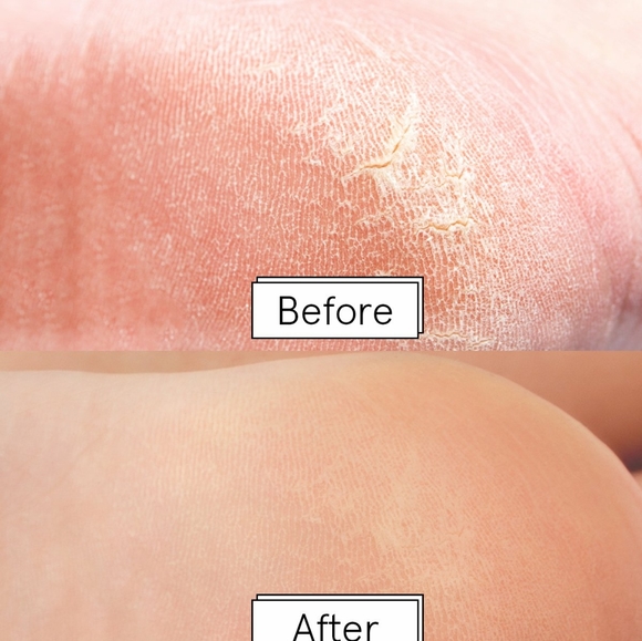 🅽🆆🆃-Dr. Pedicure Foot Mask | Fabfitfun - Picture 8 of 13